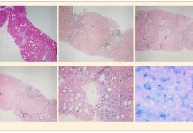 Protegido: Simposio de Patología Clínica II