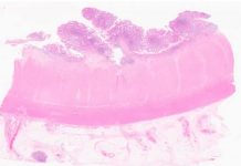 Protegido: Contenido del Simposio de Patología Endoscópica Gastrointestinal