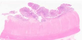 Protegido: Contenido del Simposio de Patología Endoscópica Gastrointestinal