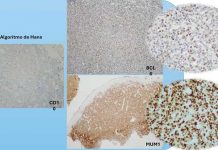 Protegido: Contenido del Simposio de Patologia Hemolinfoide