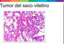 Protegido: Contenido del Simposio de Patología Pediátrica I